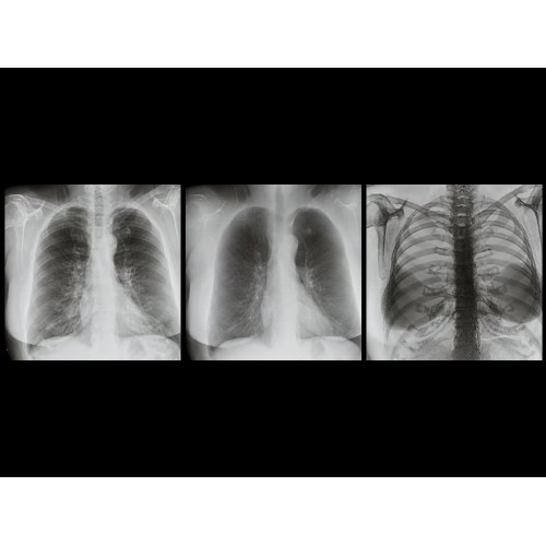 Рентген аппарат GE Discovery XR656