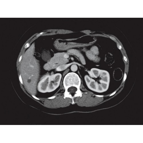 КТ аппарат GE Brivo CT385