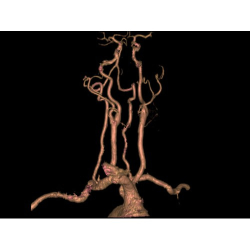 КТ аппарат GE Brivo CT385